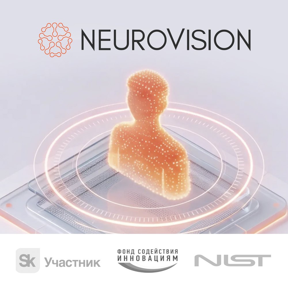NeuroVision — участник Сколково, Фонд содействия инновациям, NIST